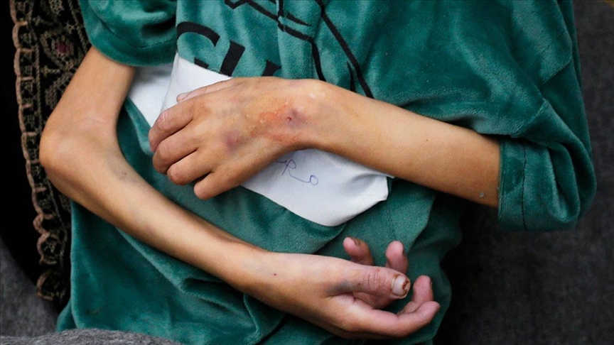 Gazze’de İnsanlık Dramı! Bir Haftada 4 Çocuk Açlıktan Öldü